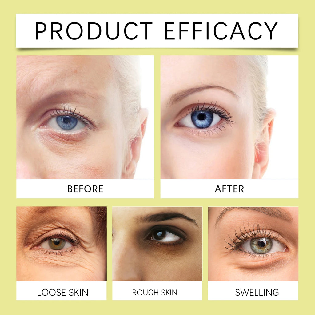 Hoygi 15g Retinol Eye Cream Gentle Renewing Formula for Delicate Eye Area Hydrates Improves Skin Texture Night Use Recommended Zpaxo