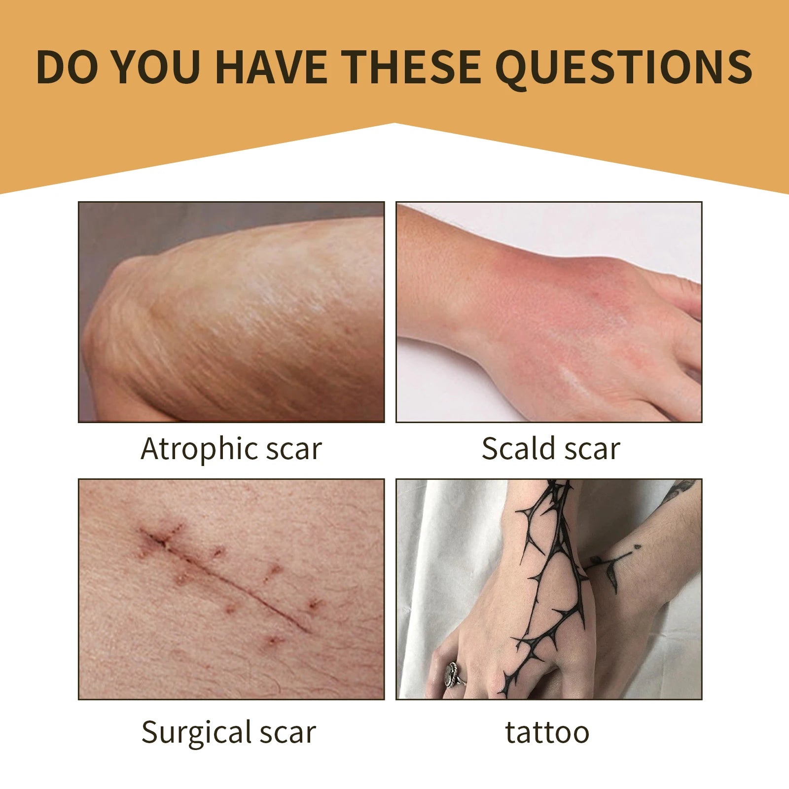 Waterproof Scar & Tattoo Cover Patches – Invisible Concealer Stickers Body Concealer Patches Zpaxo