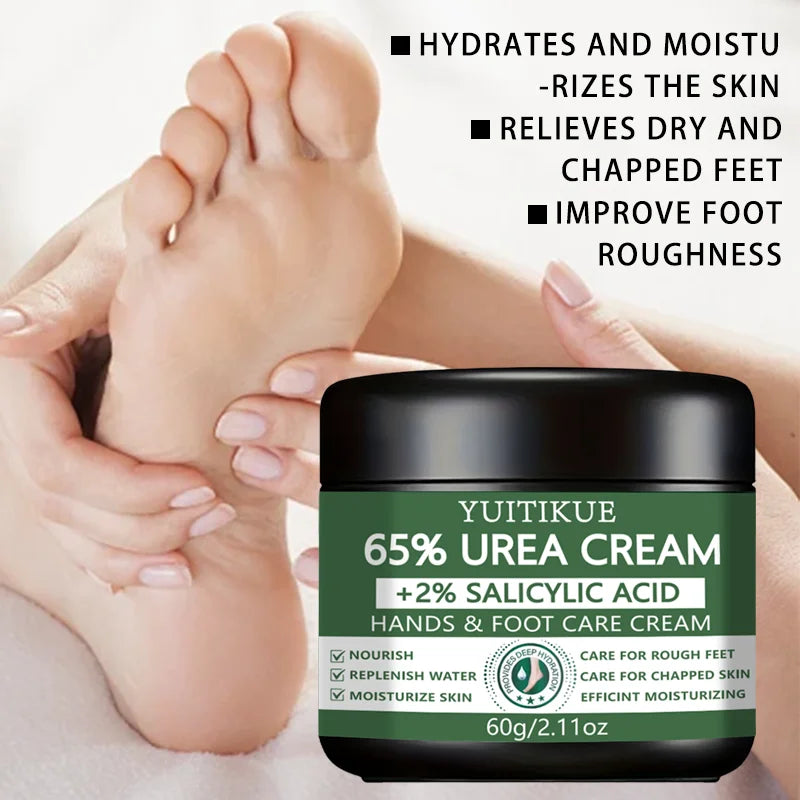 YUITIKUE 65% Urea Foot & Hand Cream – Cracked Skin Repair 60g Foot & Hand Cream Zpaxo
