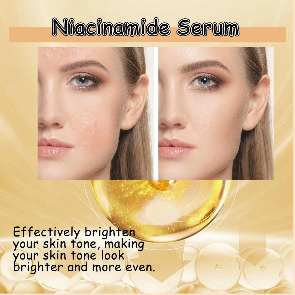 Niacinamide Serum Brightening Face Moisturizing Hydrating Glowing Zpaxo