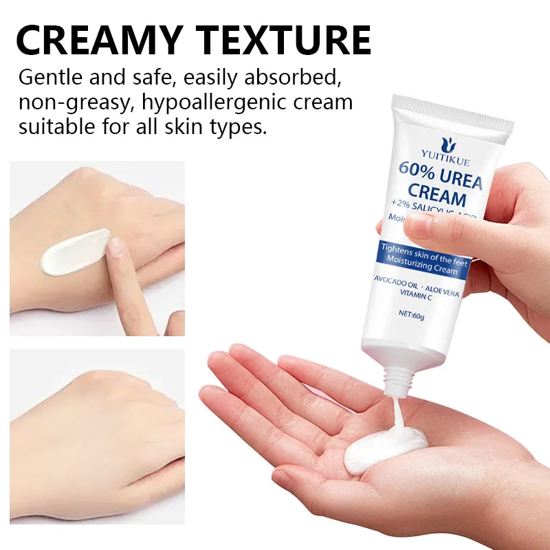 YUITIKUE 60% Urea Foot Cream – Cracked Heels & Dry Skin, 60g Foot Repair Cream Zpaxo