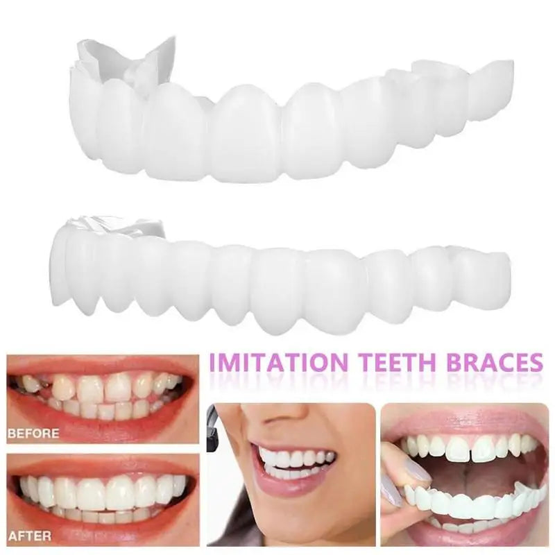 Snap-On Teeth Veneers – Reusable Temporary Smile Veneers Cosmetic Tooth Veneers Zpaxo