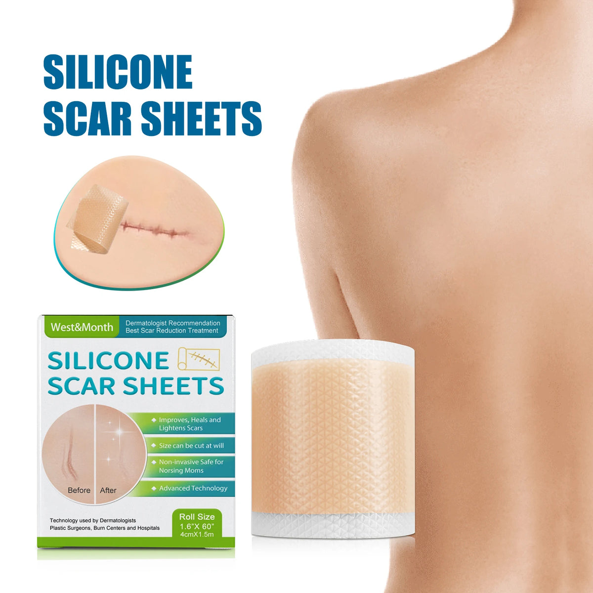 1 Roll Silicone Scar Sheets , 4cmX150cm Self-Adhesive Scar Cover Tape Reusable and Effective Skin Care Strips Zpaxo 2BOXED