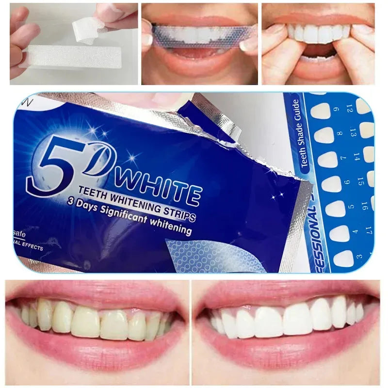Silicone Mouth Guard Tray Set – Night Guard & Teeth Whitening