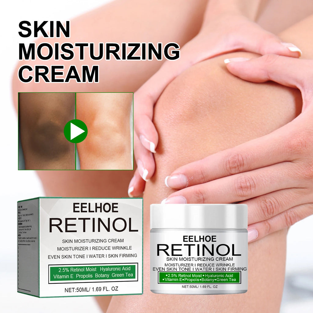 Eelhoe Retinol Brightening Cream – Dark Knees, Underarms & Body Skin Brightening Cream Zpaxo