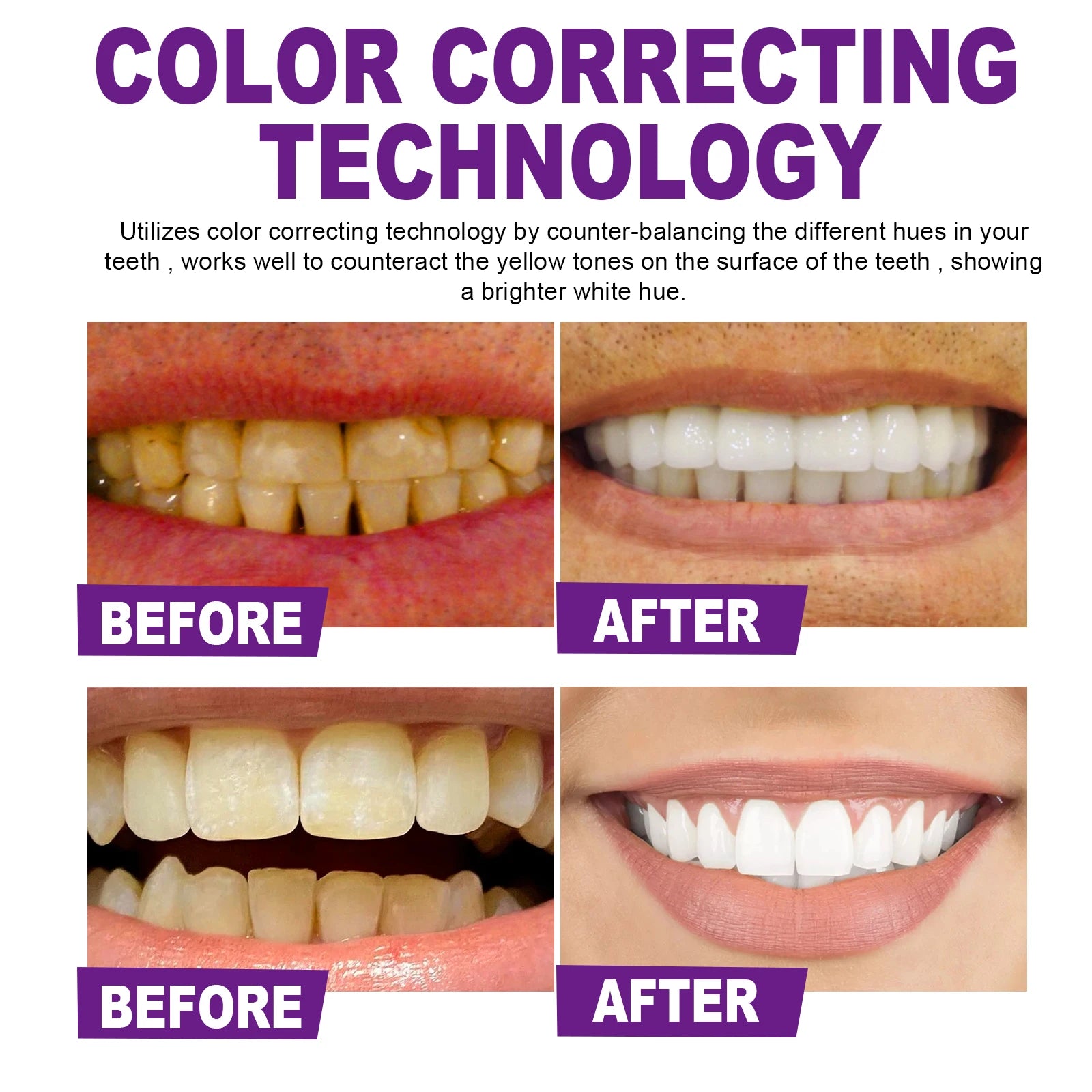 Premium Purple Brightening Toothpaste, Removes Surface Stains & Oral Odor, Gentle Gum Care, Daily Brightening & Refreshing Teeth Zpaxo