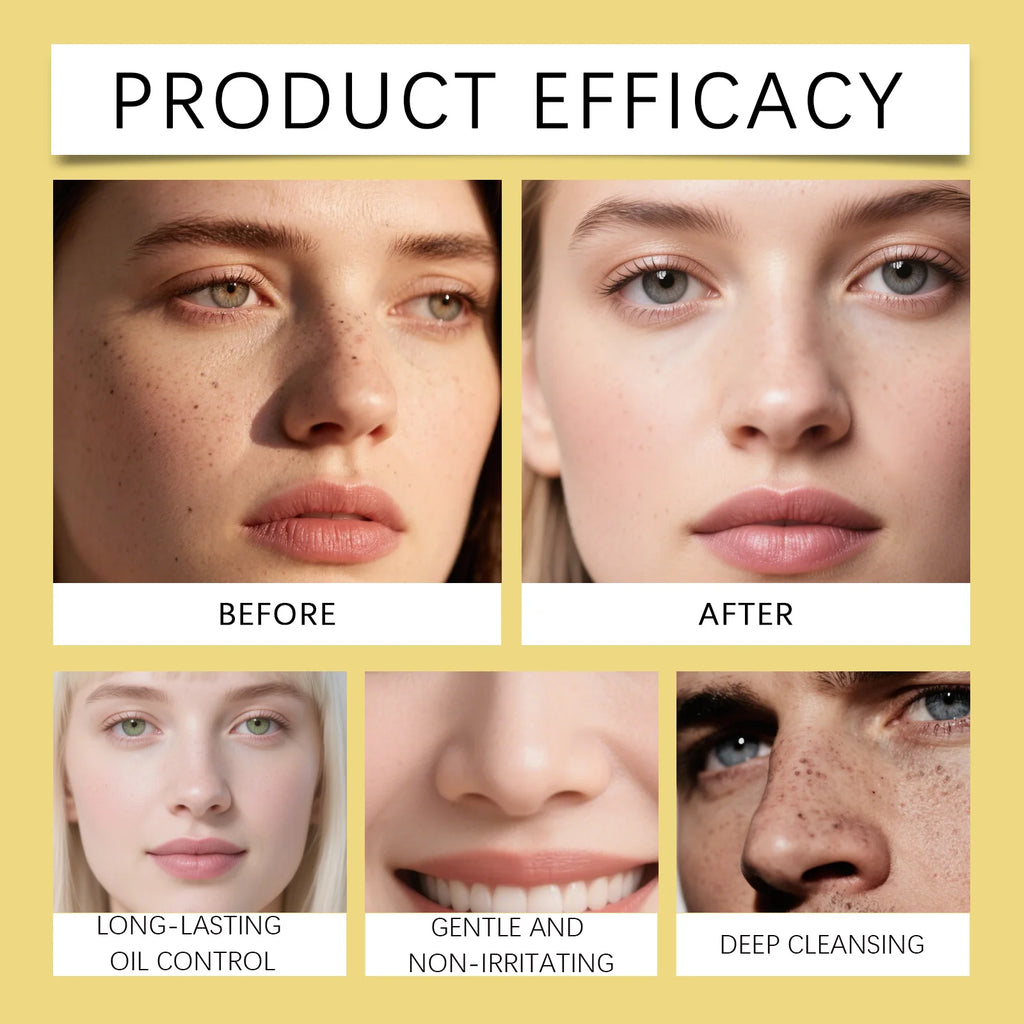 Turmeric Hyaluronic Acid Foaming Cleanser Gentle Face Wash for Oily Dull Skin Deep Pore Clean Hydrating Lather Daily Facial Care Zpaxo