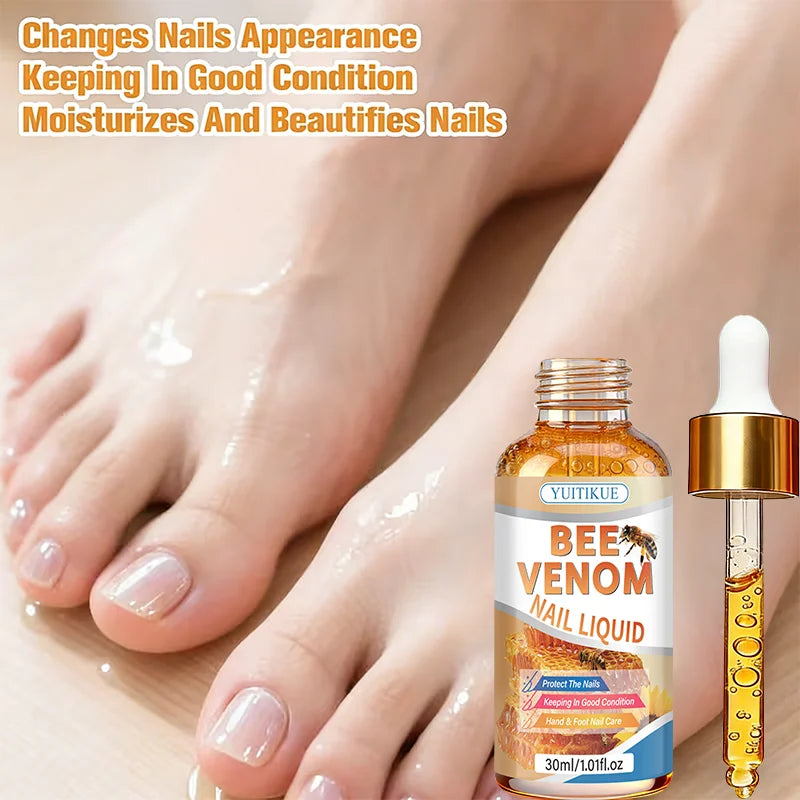 Bee Venom Nail Treatment Liquid – Moisturize & Protect Nails 30ml Nail Treatment Oil Zpaxo