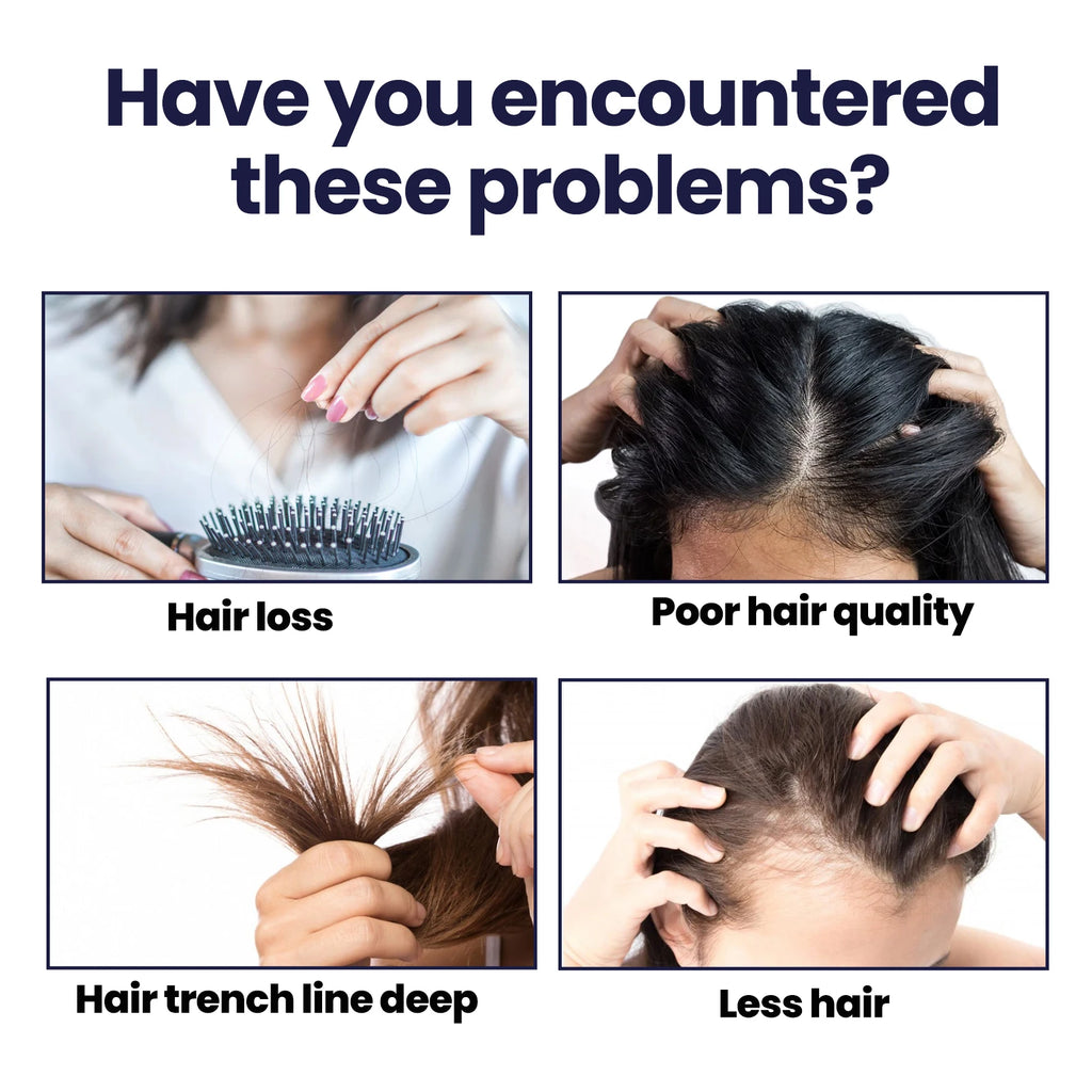 Ouhoe Hair Growth Spray Thinning Strengthen Roots Repair Dry Frizzy Collagen Formula No Residue 50ml Gentle for Sensitive Scalp Zpaxo