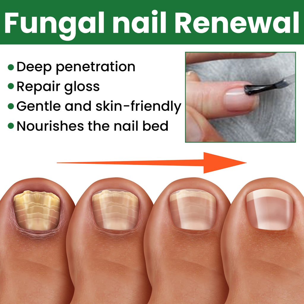 Nail Repair & Strengthening LiquidRepairs and nourishes nails, brightens, moisturizes and protects, for hand & foot nail care. Zpaxo