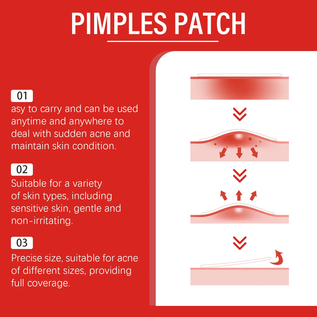 240Pcs Salicylic Acid Acne Pimple Patches Colorful Round/Heart/Flower/Star Shape Acne Removal Skin Care Stickers Covering Zits Zpaxo