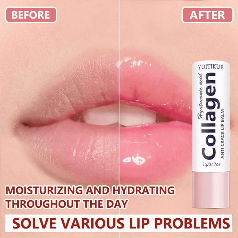 Collagen Anti-Crack Lip Balm – Hyaluronic Acid 24H Hydration Lip Balm Zpaxo