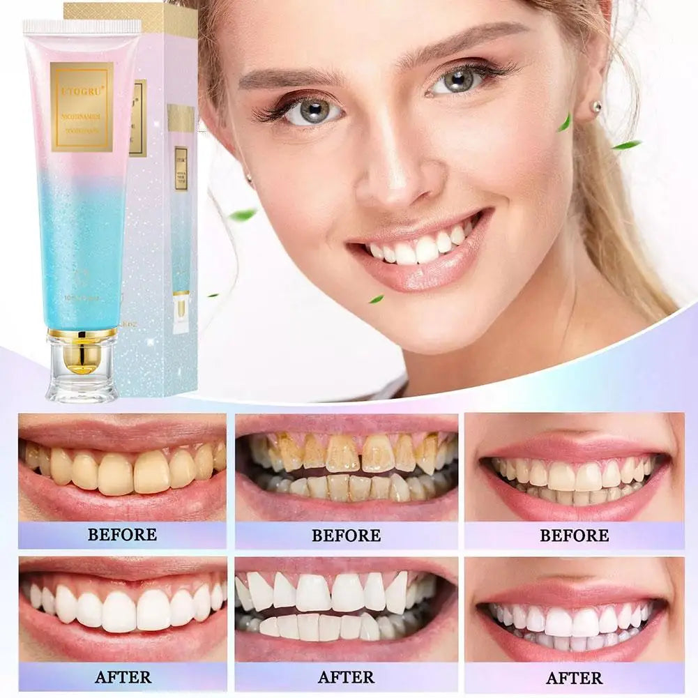1/2/3pcs Niacinamide Whitening Toothpaste Dental Stains Removing Prevent Bad Breath Oral Cleaning Reduces Plaque Toothpaste Zpaxo