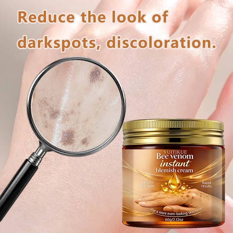 YUITIKUE Bee Venom Blemish Cream – Dark Spot Brightening 60g Blemish Cream Zpaxo