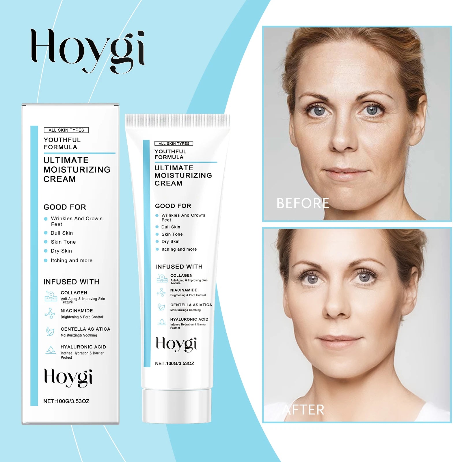 Hoygi Centella Asiatica Cica Cream Hydrating Soothing Daily Moisturizer for Sensitive Skin Brightening Anti Aging Facial Cream Zpaxo