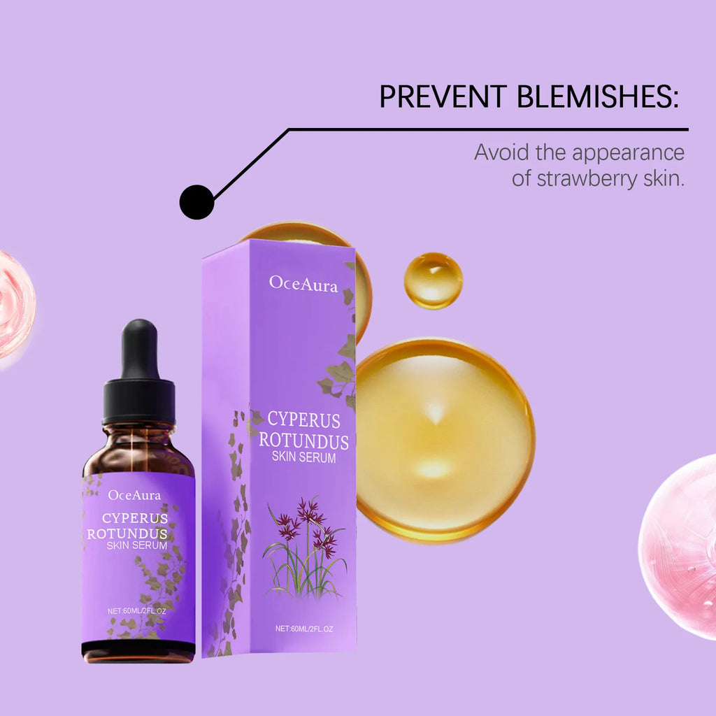 Cyperus Rotundus Hair Growth Inhibitor Serum | OceAura 60ml Hair Growth Inhibitor Serum Zpaxo