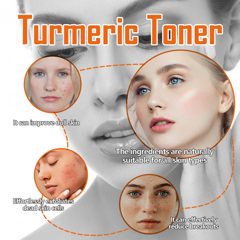 Turmeric Toner Dark Spots Removal Brightening Spots Corrector Remove Freckle Fade Melasma Moisturizing Turmeric Face Toner Zpaxo