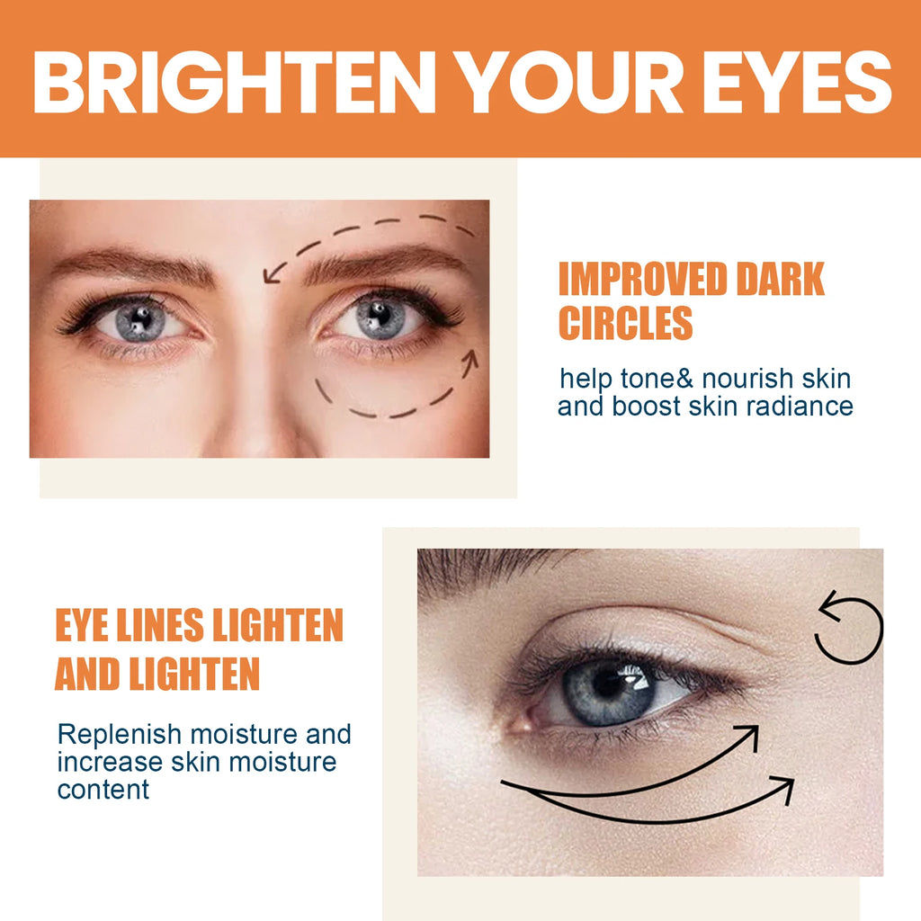 Vitamin C Eye Balm – Dark Circles, Bags & Fine Lines Eye Cream Stick Zpaxo