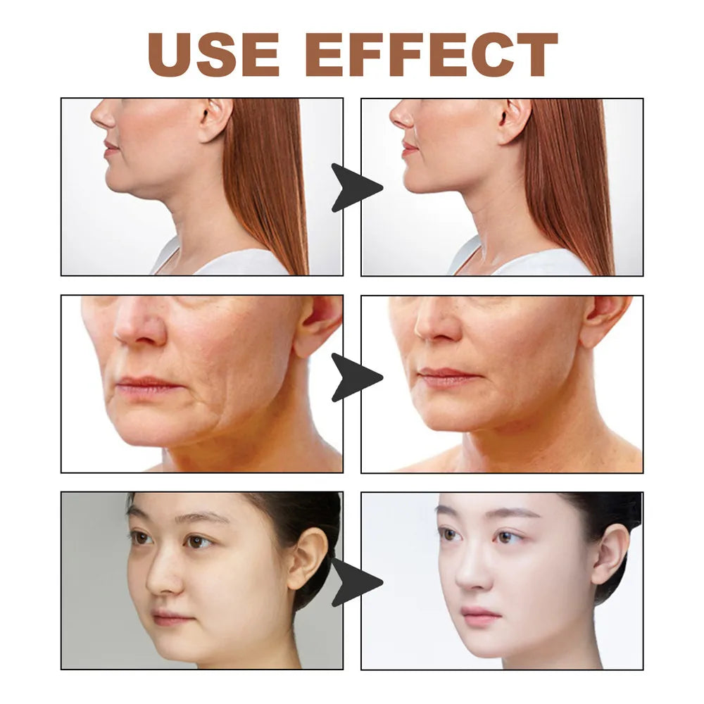Face Lift Band Face Anti-sagging Lift Remove Eye Wrinkles V-shaped Face Breathable Lifting Face Paste Reusable Face Lift Tape Zpaxo
