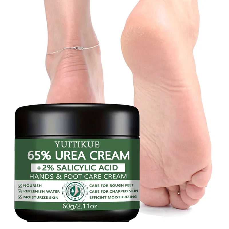 YUITIKUE 65% Urea Foot & Hand Cream – Cracked Skin Repair 60g Foot & Hand Cream Zpaxo Default Title