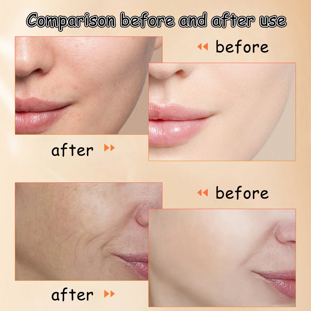 Ouhoe Brightening Face Serum Hydrating and Smoothing Improves Skin Texture 30ml No Irritation Gentle for Sensitive Dry Oily Skin Zpaxo