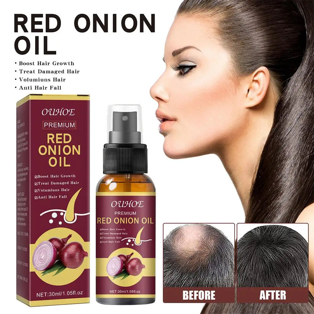1/2/3pcs Red Onion Hair Care Essential Oil Hair Care Spray Nourish Hair Roots Improve Hair Texture Hair Care Zpaxo