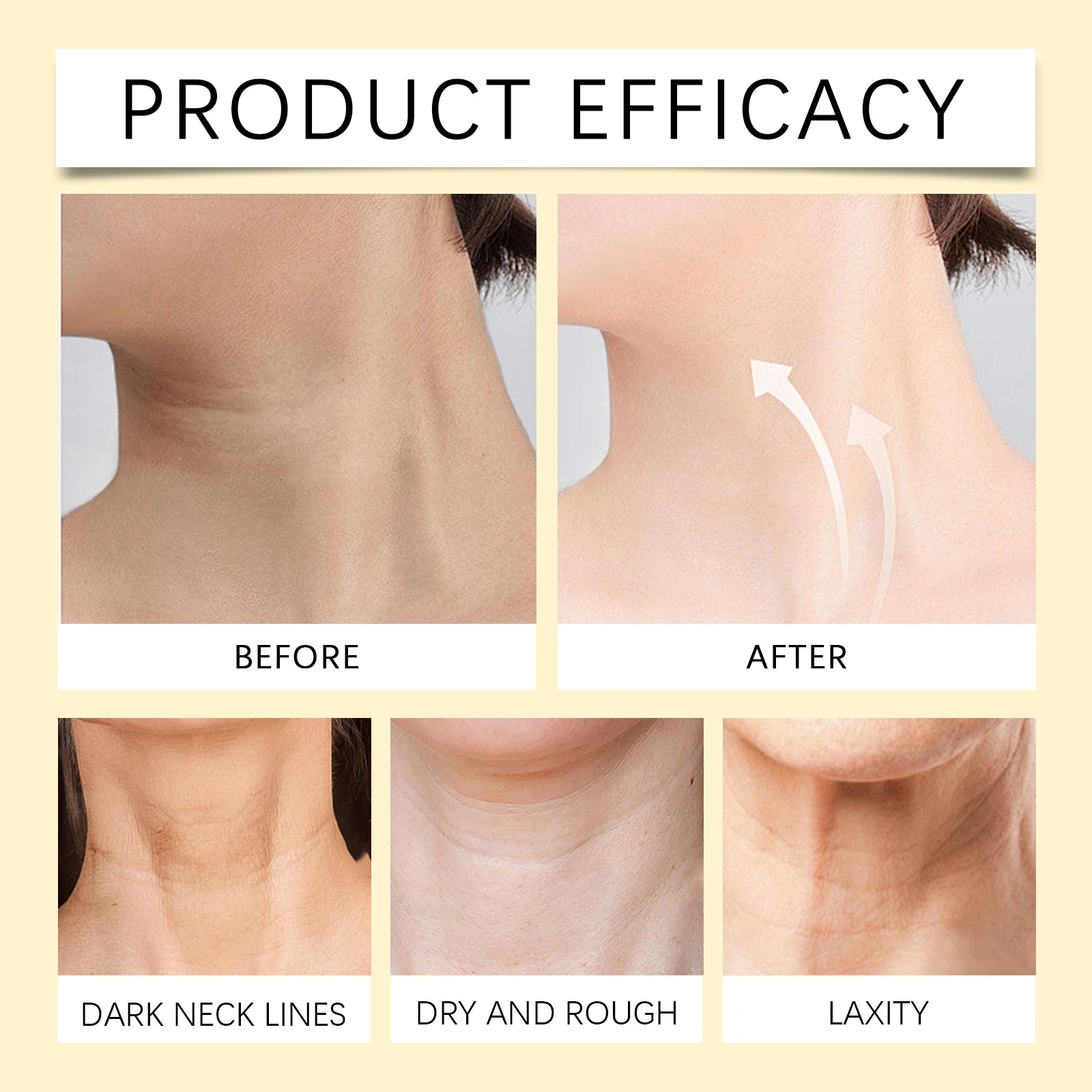 Bee Venom Neck Cream Stick – Collagen Lift, Firm & Tighten Neck Firming Cream Zpaxo