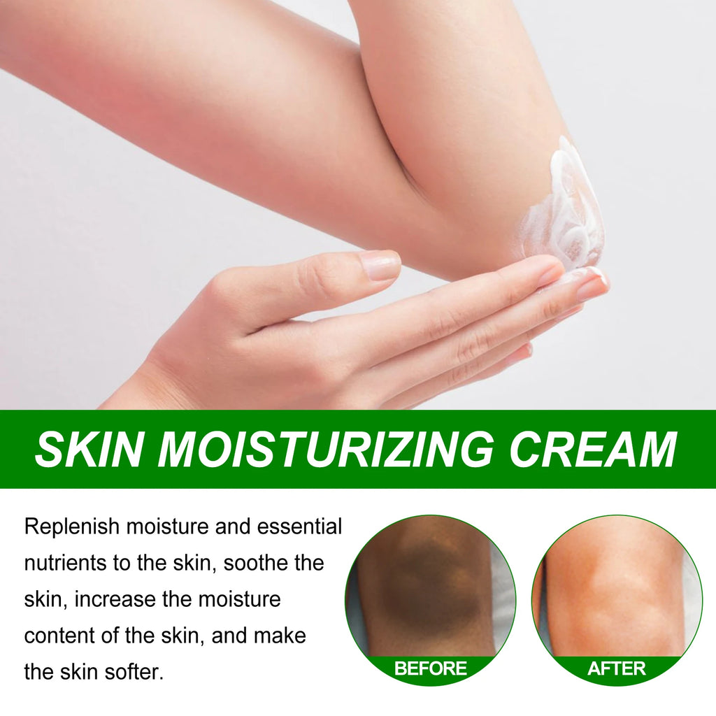 Eelhoe Retinol Brightening Cream – Dark Knees, Underarms & Body Skin Brightening Cream Zpaxo
