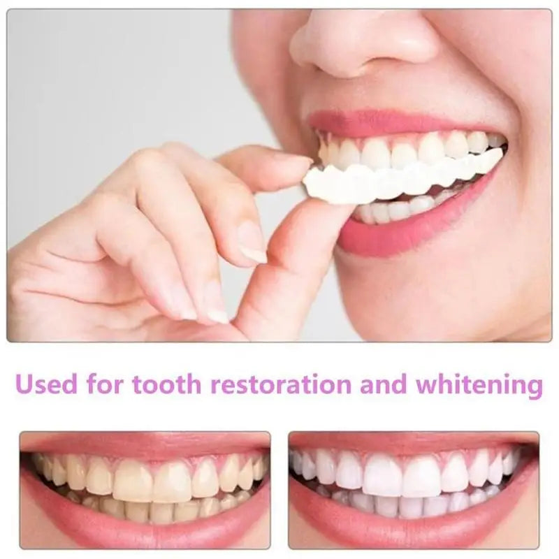 Snap-On Teeth Veneers – Reusable Temporary Smile Veneers Cosmetic Tooth Veneers Zpaxo