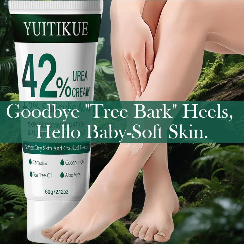 YUITIKUE 42% Urea Cream – Cuticle Softener & Dry Skin Relief 60g Urea Foot Cream Zpaxo