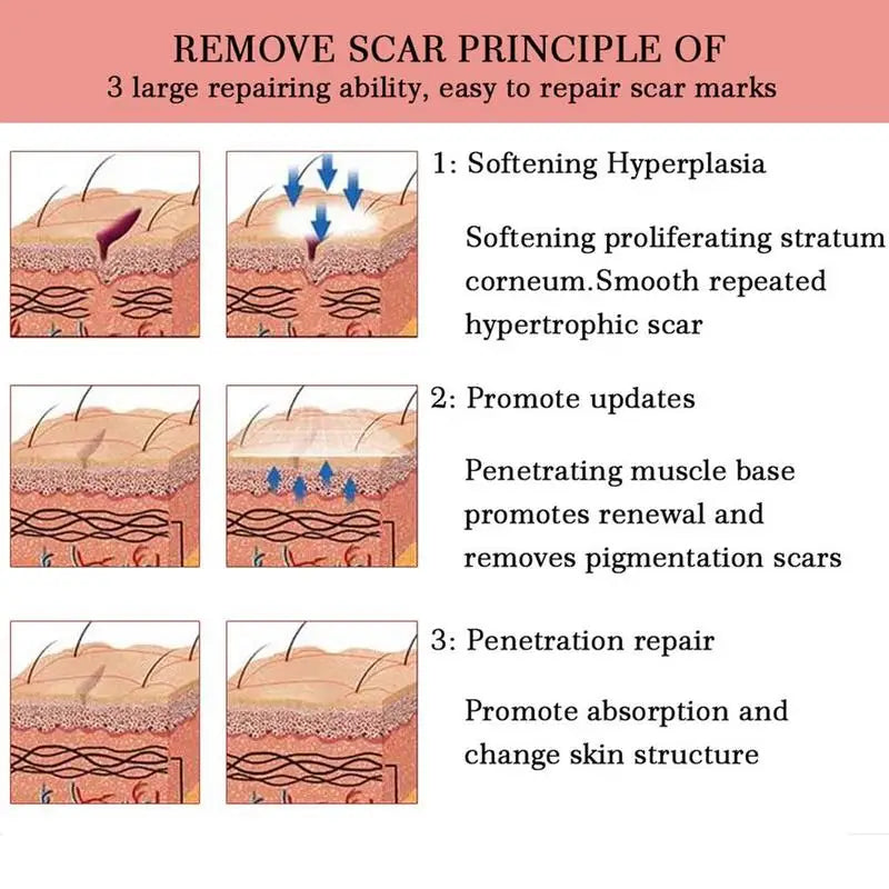 Lavender Scar Repair Cream – Fades Acne Marks & Smoothes Skin Scar Repair Cream Zpaxo