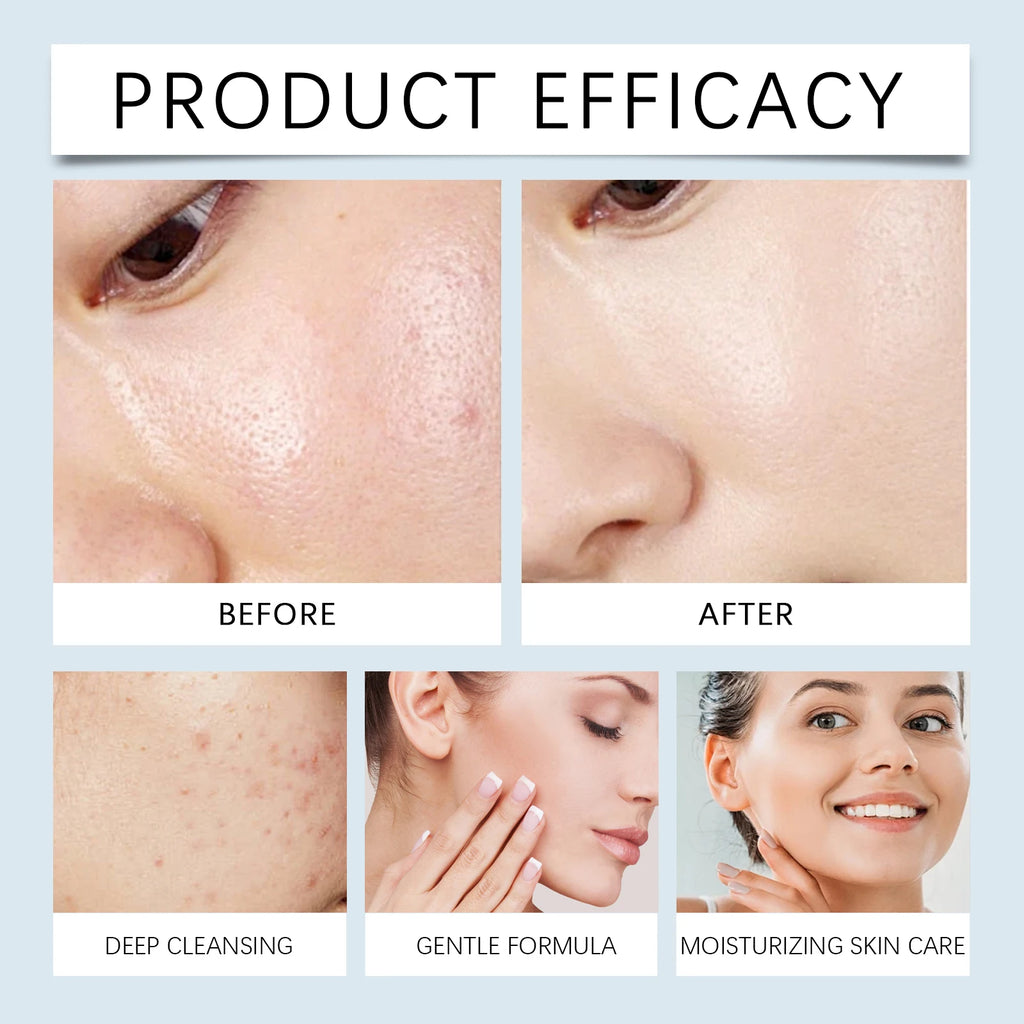 Hoygi 120ml Double Cleansing Gentle Makeup Remover for Face Eyes Soybean Oil Niacinamide No Residue Non Greasy Vegan Cleanser Zpaxo