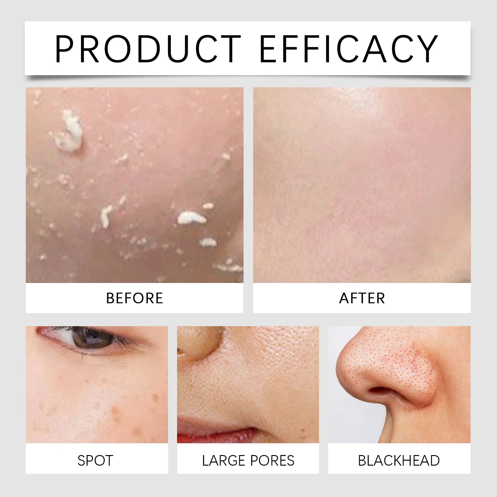 Salicylic Acid Exfoliating Toner 100ml Pore Minimizer Blemish Control Liquid Papaya Extract Hydrating Facial for Acne Prone Skin Zpaxo
