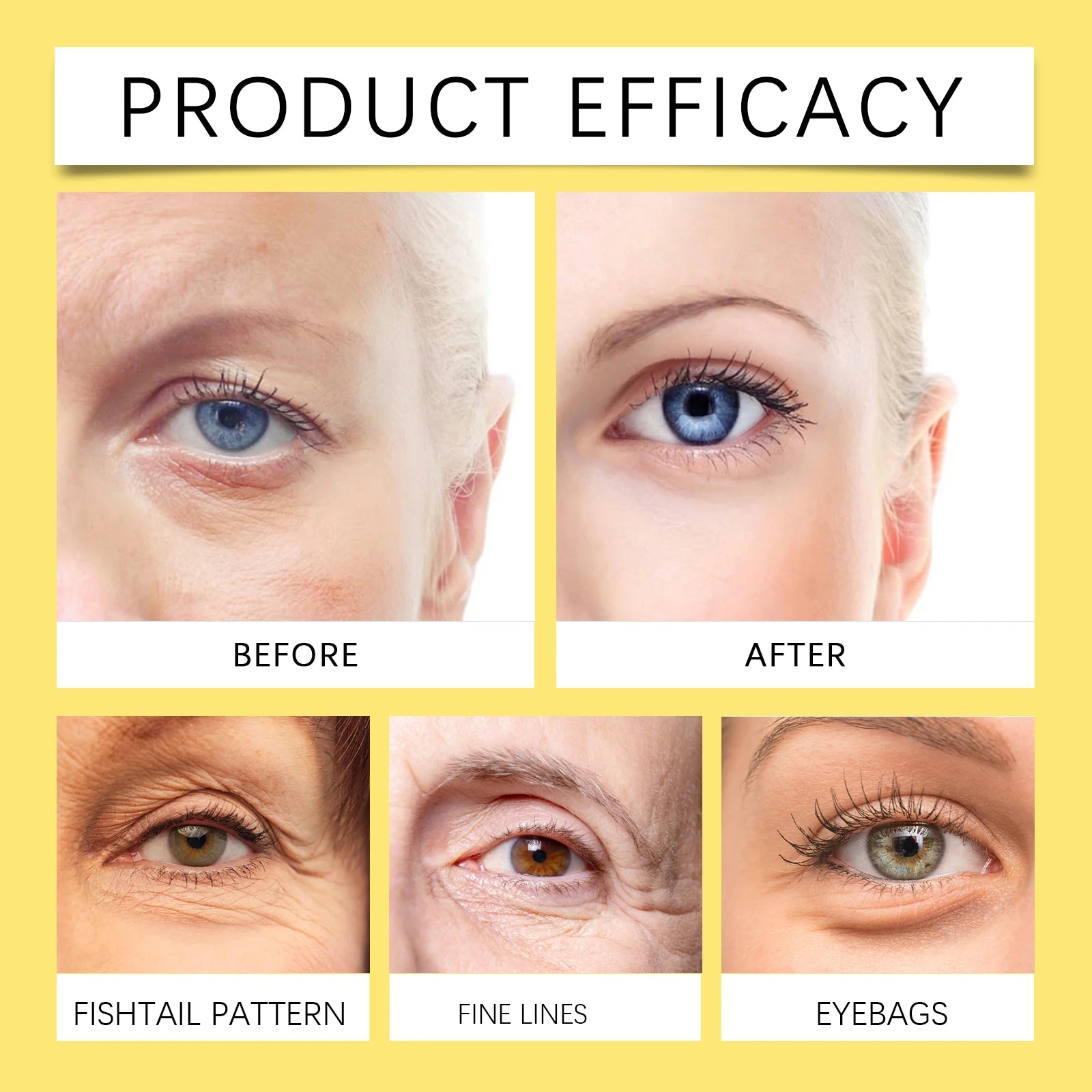 Snail Essence Eye Patches Dark Circles and Wrinkles Hydrating Under Eye Mask Deep Moisture Anti Aging Rejuvenating Gel Pads60pcs Zpaxo