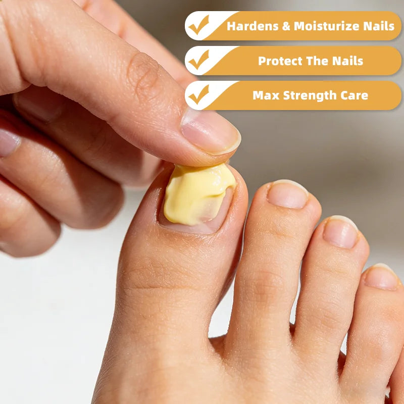 Bee Venom Nail Care Cream – Strengthens & Smooths Nails 60g Nail Treatment Cream Zpaxo
