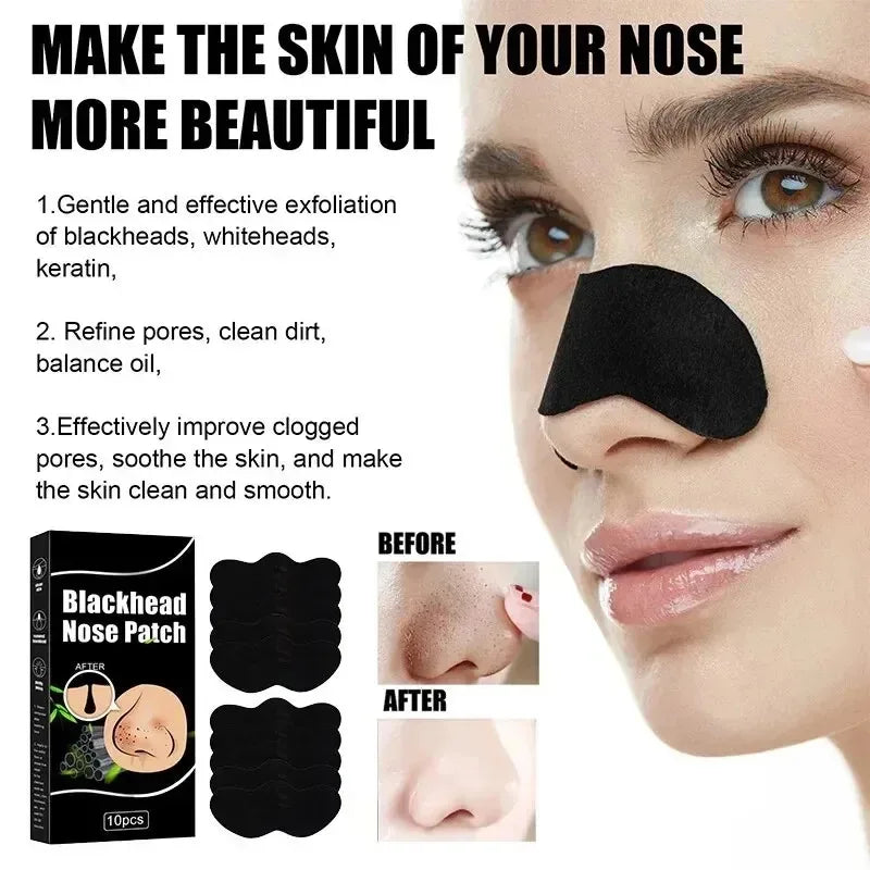 Nose Strips Blackhead & Whitehead Remover – Pore Cleansing Patches