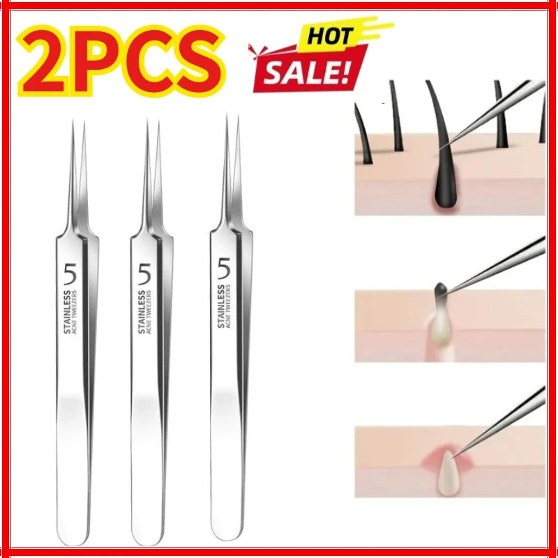 3PCS Easy-To-Use Stainless Steel Acne Extractor Set - Hypoallergenic Beauty Tweezers For Clear Skin, Perfect For Beginners Zpaxo 3PCS-Silver