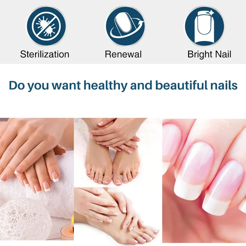 YUITIKUE 7-Day Ginger King Nail Care Cream – Renew Nails 60g Nail Treatment Cream Zpaxo