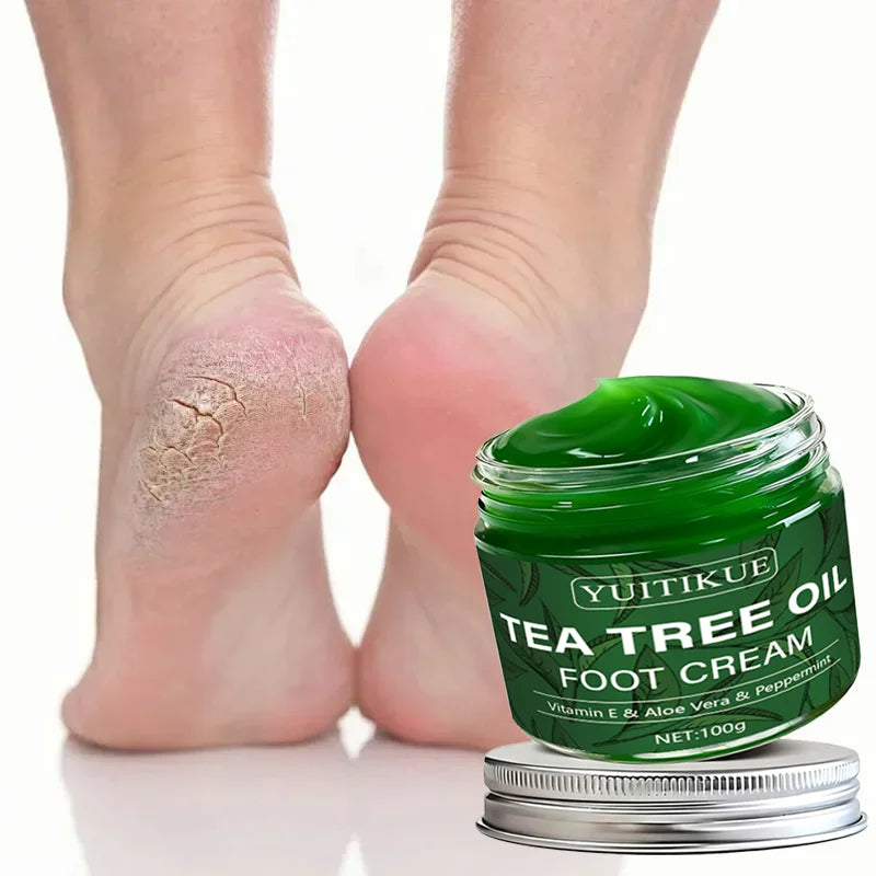 YUITIKUE Tea Tree Oil Foot Cream 100g | Vitamin E & Aloe Foot Cream Zpaxo
