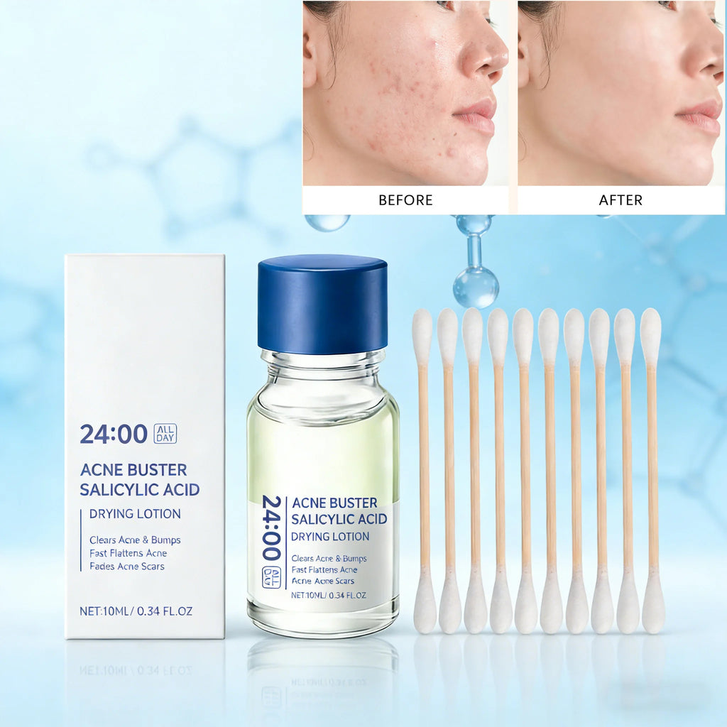 Hoygi Salicylic Acid Acne Serum – Blackhead & Pore Control Acne Spot Treatment Zpaxo