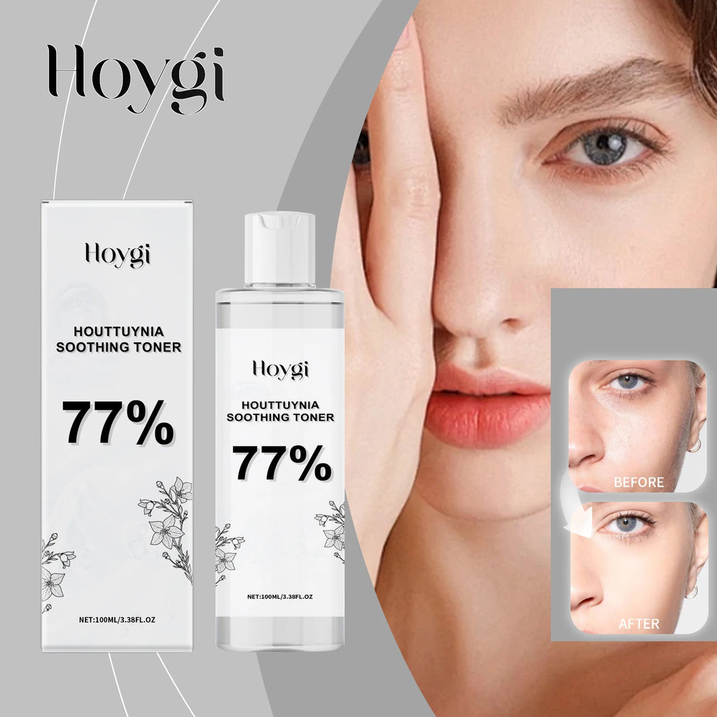 Hoygi 100ml Houttuynia Cordata Facial Toner Hydrating Essence with Hyaluronic Acid Brighten Soothe Boost Radiance Natural Herb Zpaxo