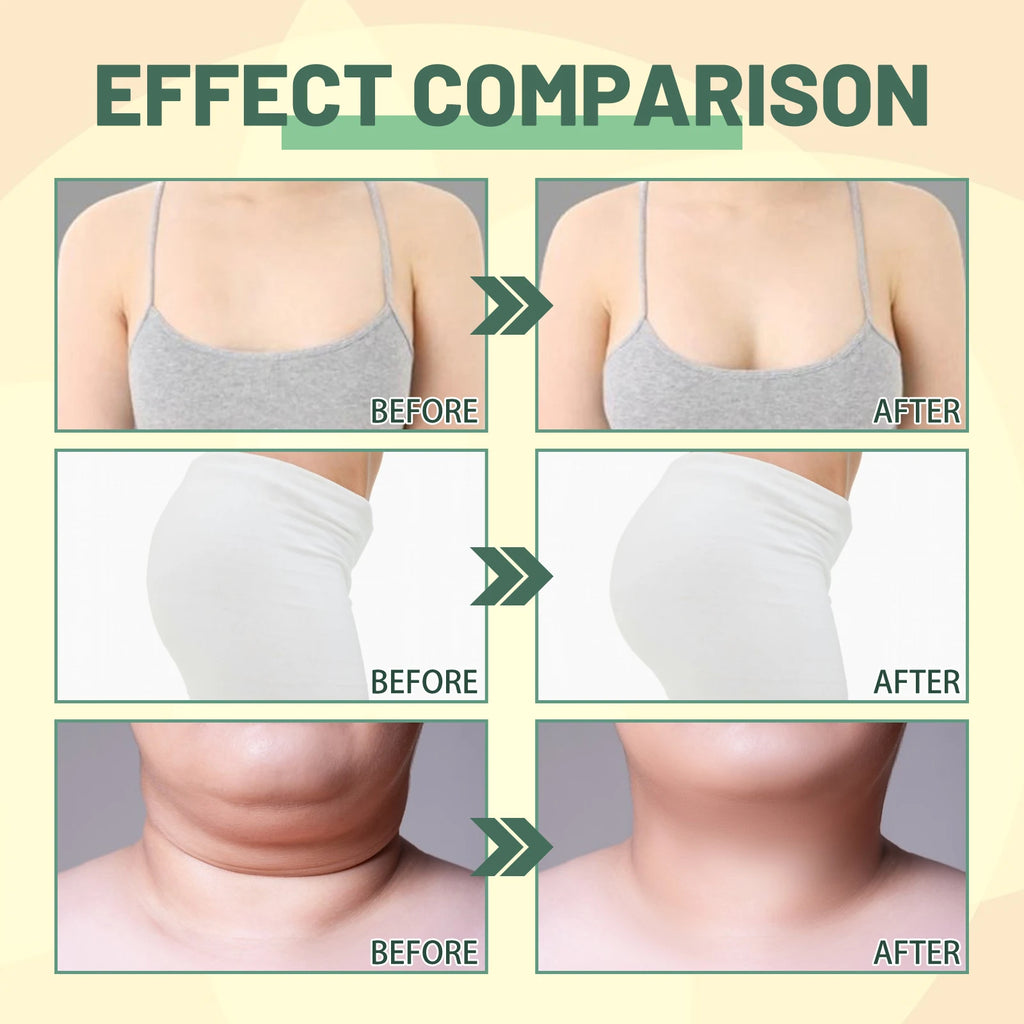 Ouhoe Collagen Body Oil for Skin Tightening and Firming Anti Stretch Mark Massage Oil for Belly Thighs Butt Body Sculpting 30ml Zpaxo