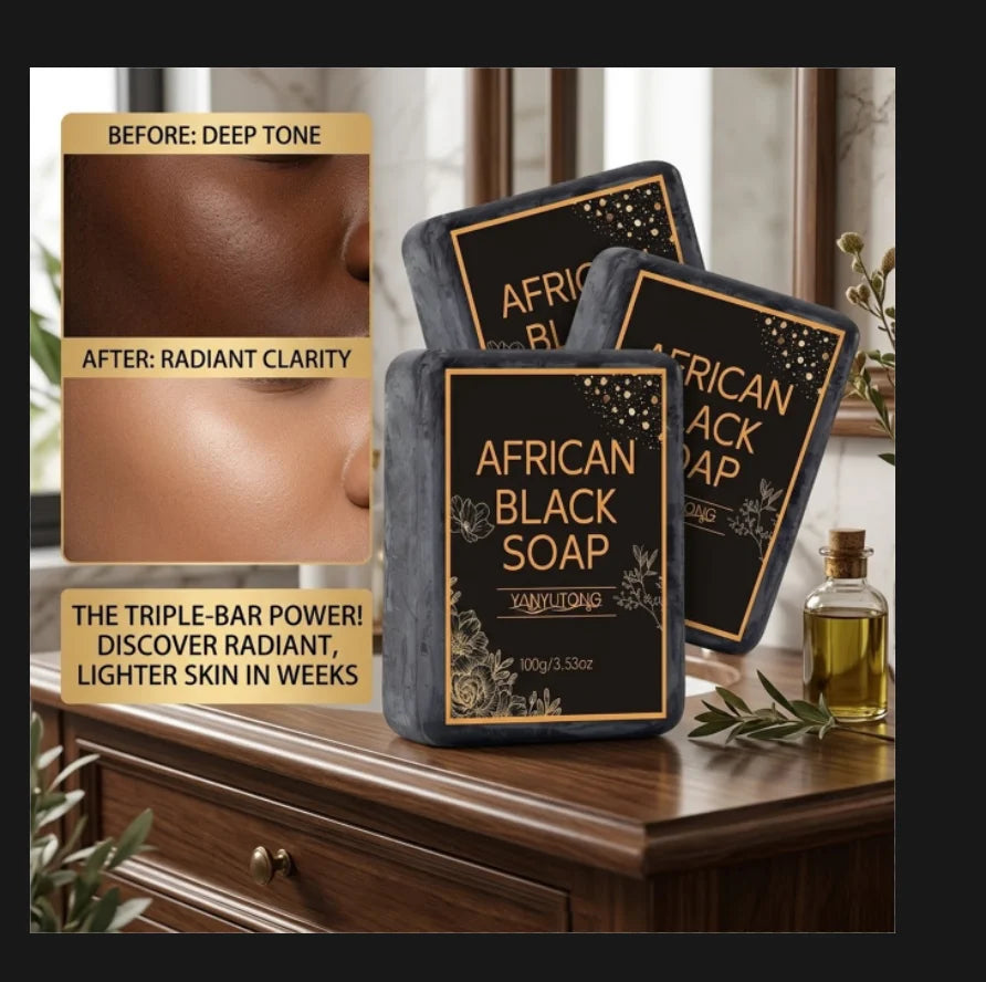 African Black Soap with Shea Butter – Deep Cleanse & Hydrate Handmade Bar Soap Zpaxo 3PCS