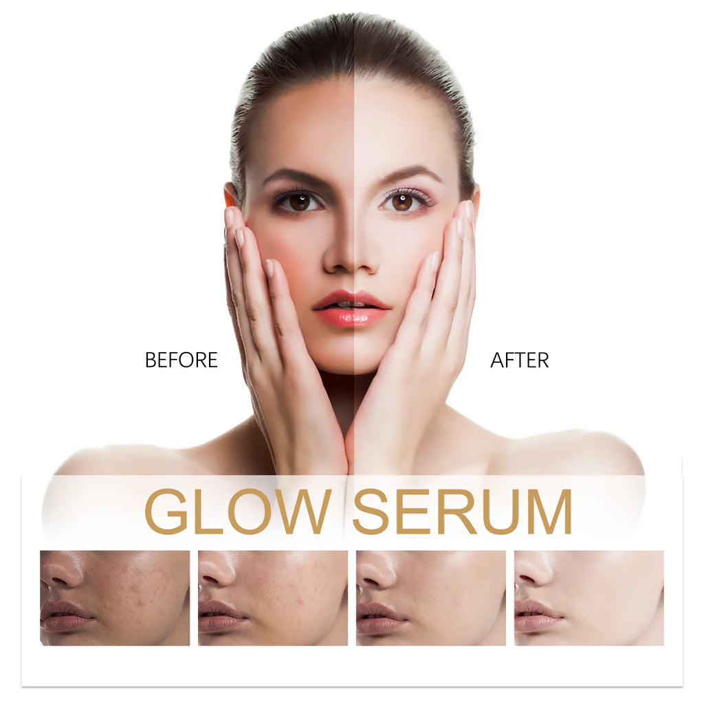 Glow Serum Propolis and Niacinamide Hydrating Facial Soothing Moisturizer Lighten Acne Marks Whitening Facial Essence Zpaxo