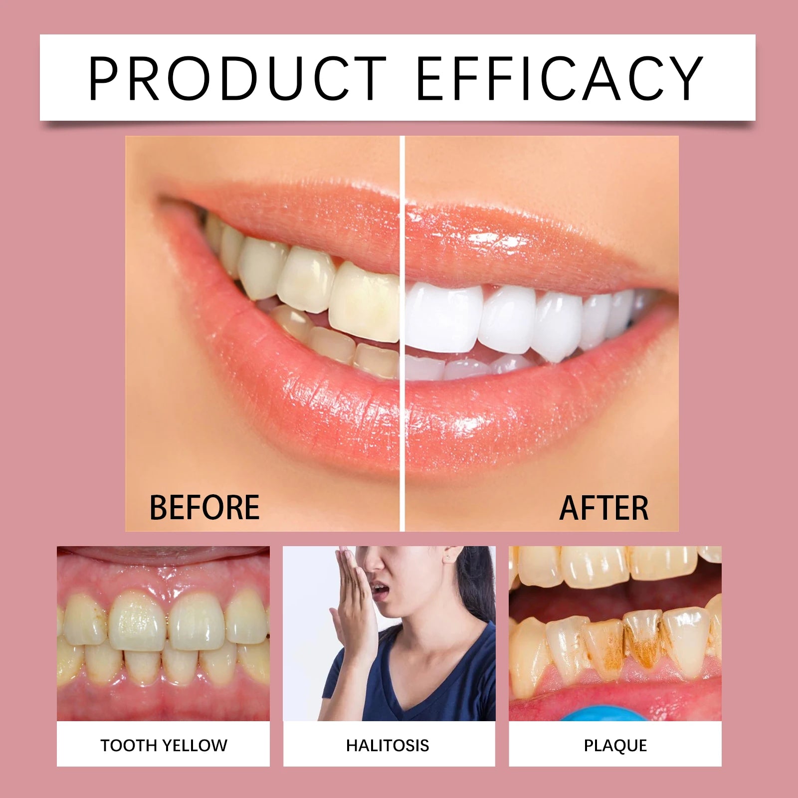 Probiotic Whitening Toothpaste Improves Yellow Teeth Mint Flavors Fresh Breath Toothpaste Removal Stain Charcoal Stains Product Zpaxo