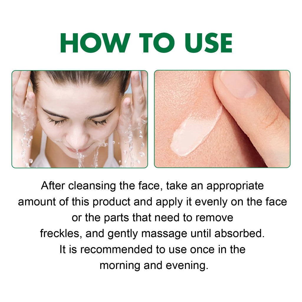 Nicotinamide Dark Spot Corrector Serum | Eelhoe 50ml Brightening Face Serum Zpaxo