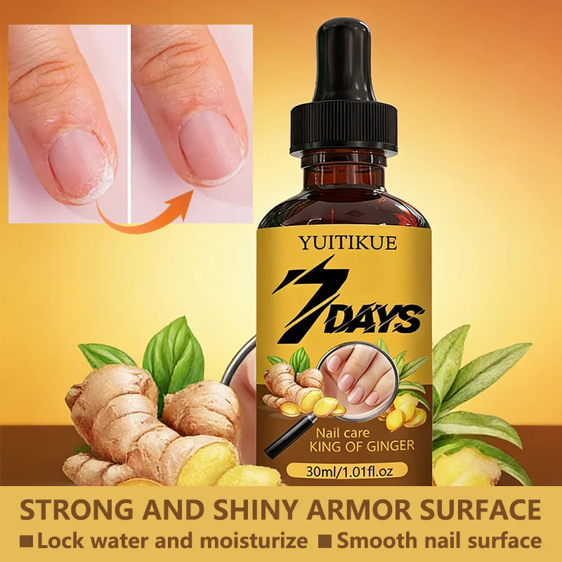 YUITIKUE 7-Day Ginger Nail Care Oil – Nourish & Strengthen 30ml Nail Treatment Oil Zpaxo