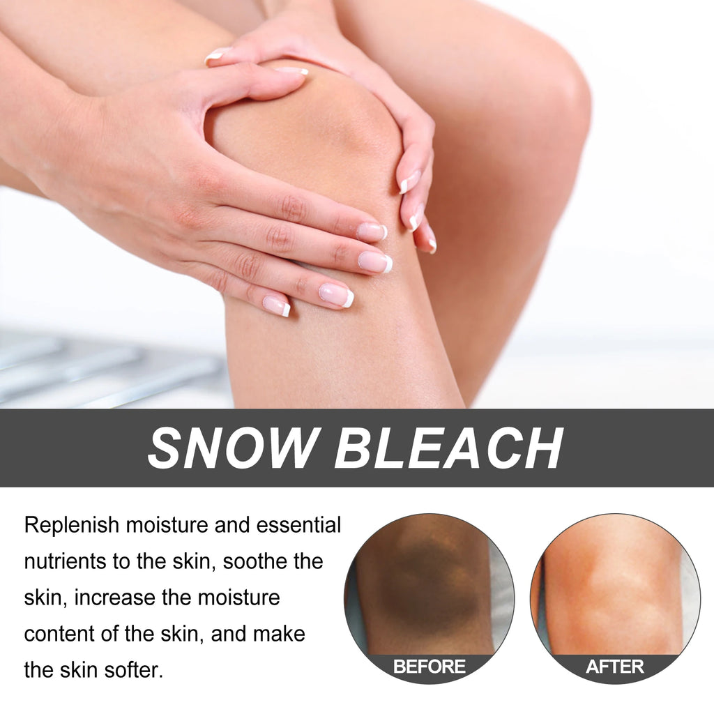 Remove Dark Spots from Underarms and Thighs Lighten Pigmentation on Inner Thighs and Joints Brightening Skin Cream Zpaxo