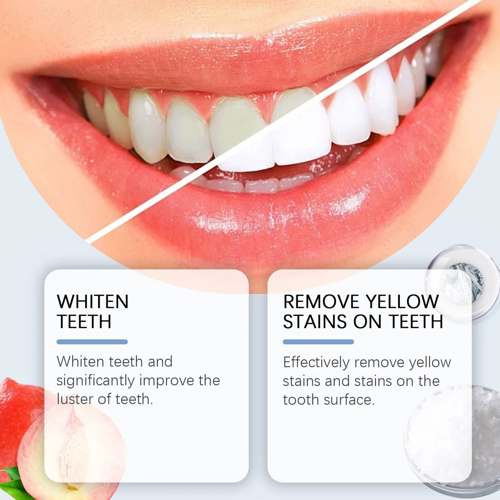 Niacinamide Bleaching Toothpaste Remove Tartar Reduce Tooth Plaque Stains Clean Oral Hygiene Breath Teeth Whitening Toothpaste Zpaxo