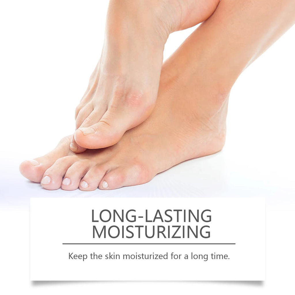 WIYUN 40% Urea Foot Cream – Cracked Heels & Callus Repair Urea Foot Cream Zpaxo